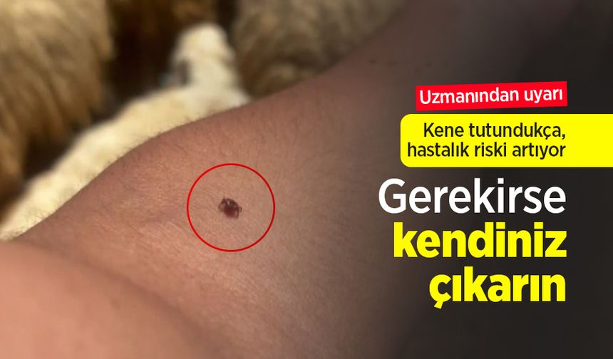 Uzmanından uyarı: Kene tutundukça, hastalık riski artıyor: "Gerekirse kendiniz çıkarın"