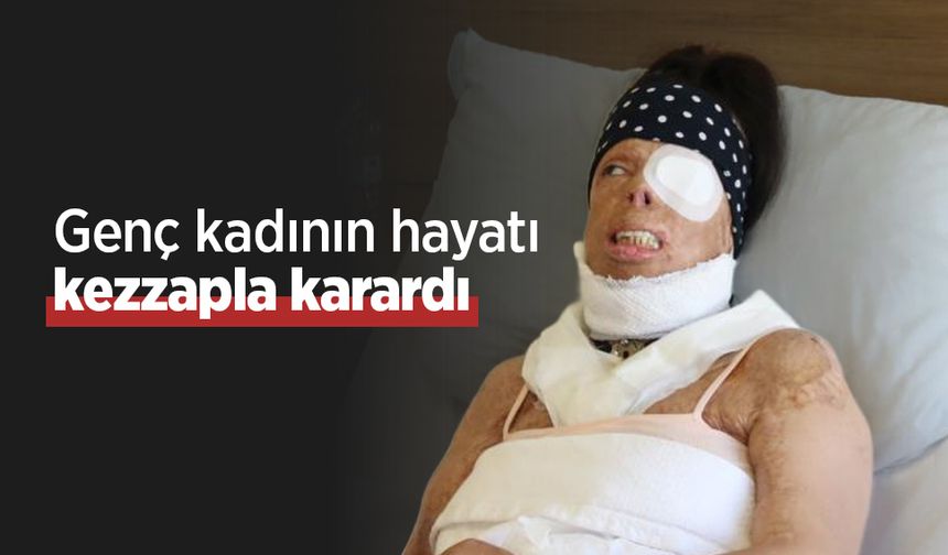 Genç kadının hayatı kezzapla karardı