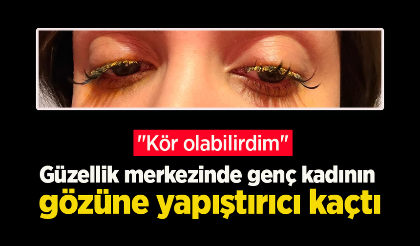 Güzellik merkezinde genç kadının gözüne yapıştırıcı kaçtı: "Kör olabilirdim"