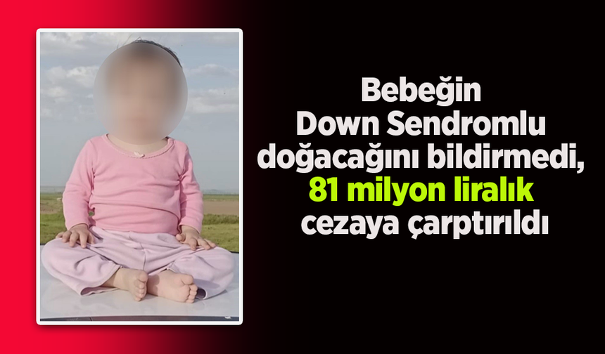 Bebeğin Down Sendromlu doğacağını bildirmedi, 81 milyon liralık cezaya çarptırıldı