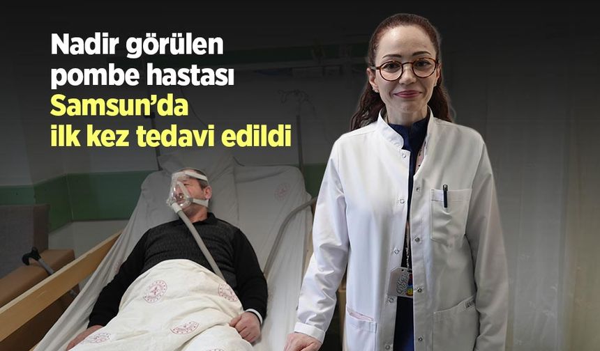Nadir görülen pombe hastası Samsun’da ilk kez tedavi edildi