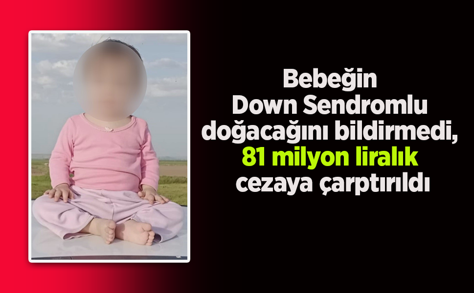 Bebeğin Down Sendromlu doğacağını bildirmedi, 81 milyon liralık cezaya çarptırıldı