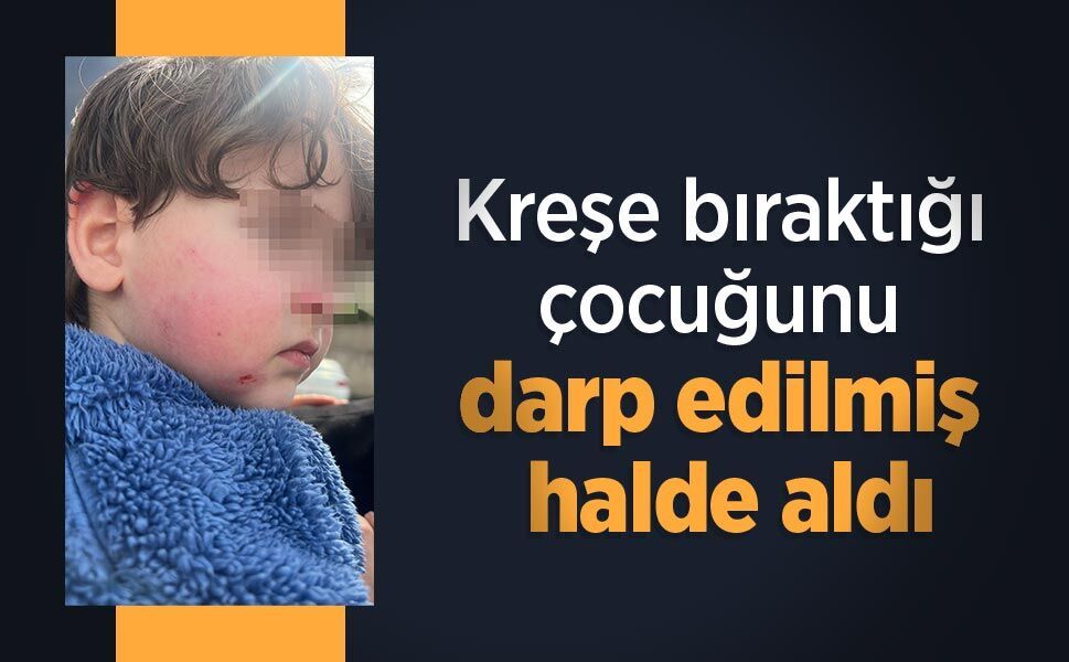 Kreşe bıraktığı çocuğunu darp edilmiş halde aldı