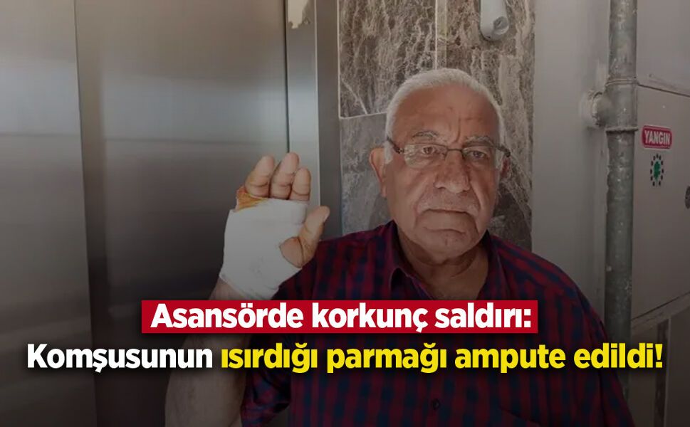 Asansörde korkunç saldırı: Komşusunun ısırdığı parmağı ampute edildi!