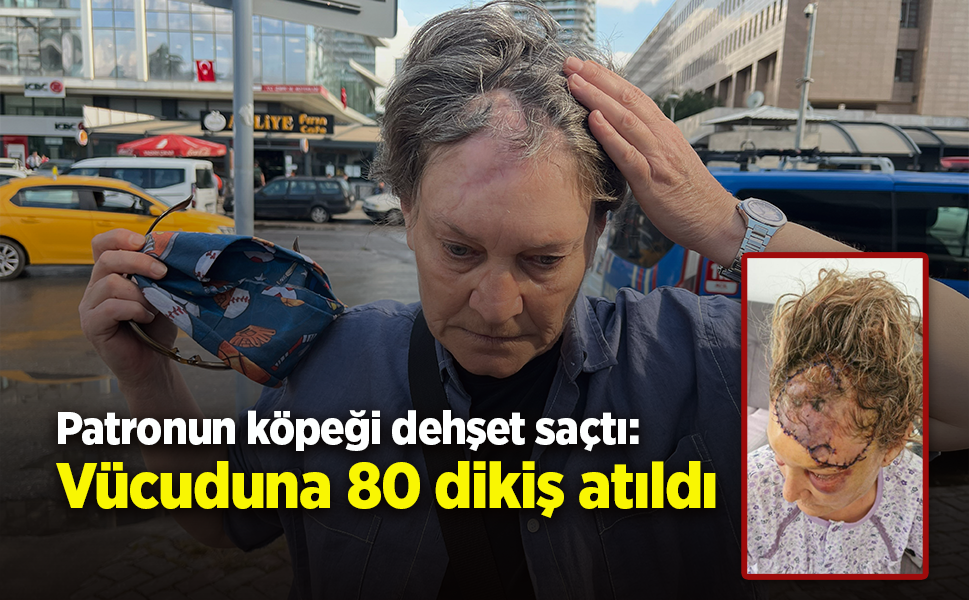 Patronun köpeği dehşet saçtı: Vücuduna 80 dikiş atıldı