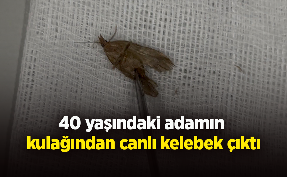 40 yaşındaki adamın  kulağından canlı kelebek çıktı