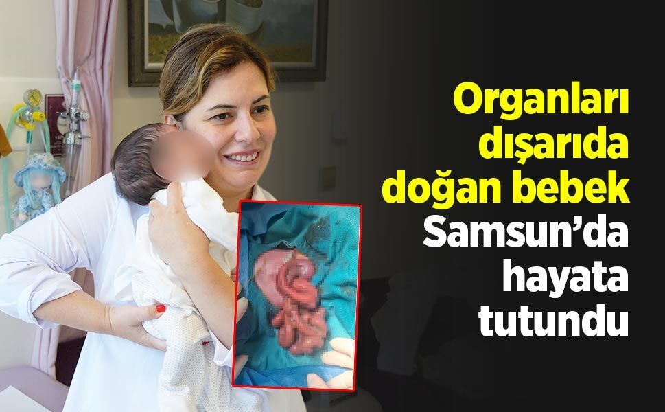Organları dışarıda doğan bebek, Samsun’da hayata tutundu