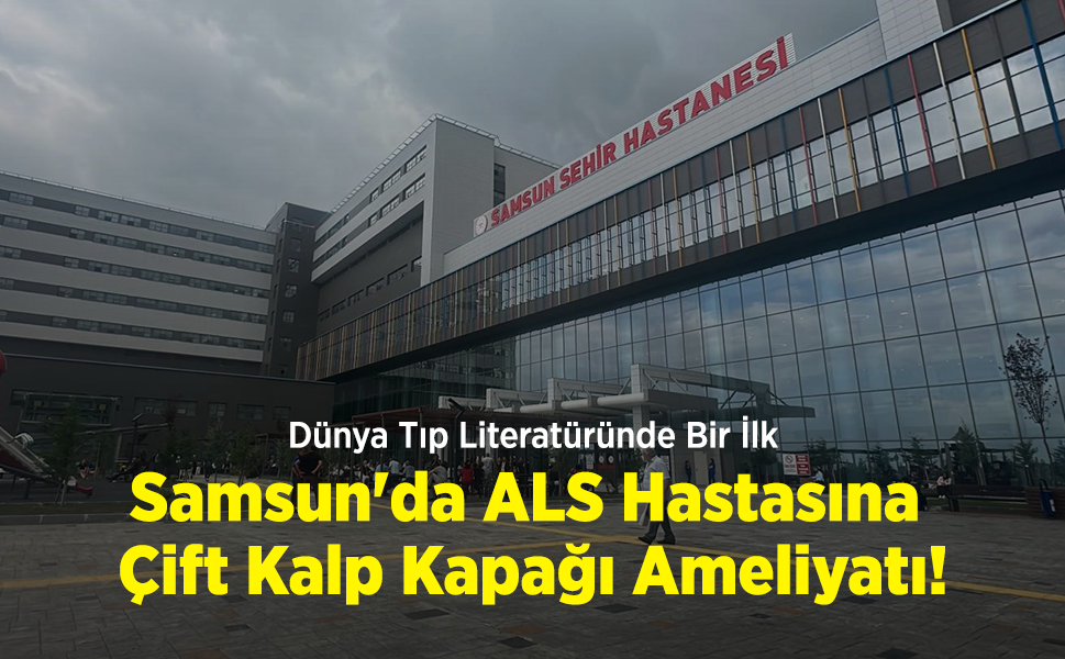 Dünya Tıp Literatüründe Bir İlk: Samsun'da ALS Hastasına Çift Kalp Kapağı Ameliyatı!
