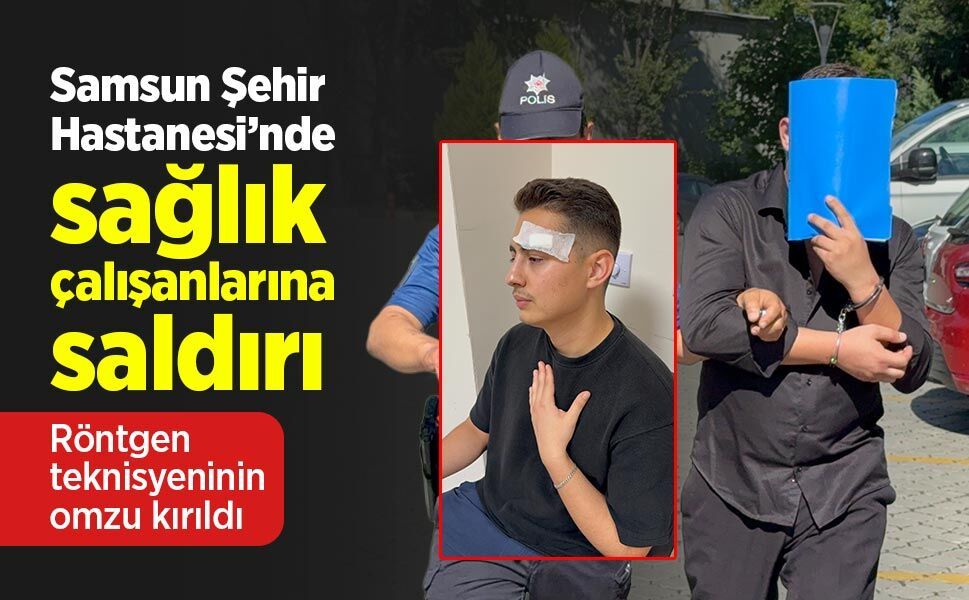 Samsun Şehir Hastanesi’nde sağlık çalışanlarına saldırı: Röntgen teknisyeninin omzu kırıldı