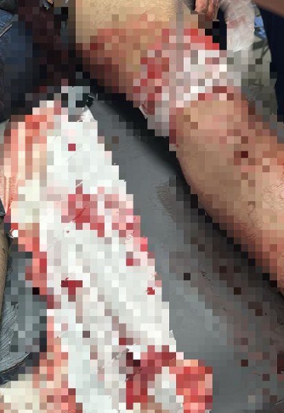 A W616436 02 413X600