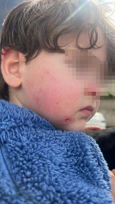 A W681140 01 225X400