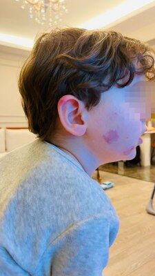 A W681140 02 225X400