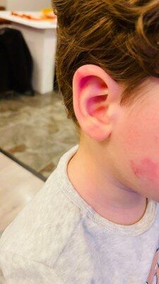 A W681140 04 225X400