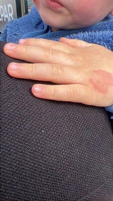 A W681140 05 225X400