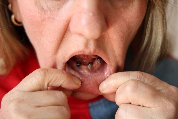 A W690364 03 600X400